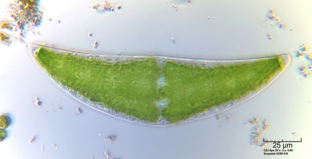 Closterium